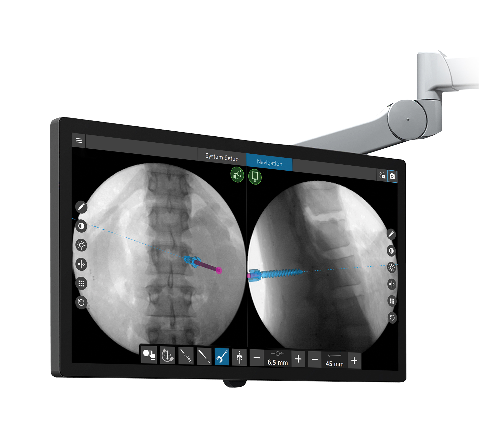 Spinemap Go Software Stryker Neurosurgical And Advanced - 